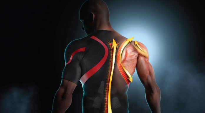 LP Support is on Point